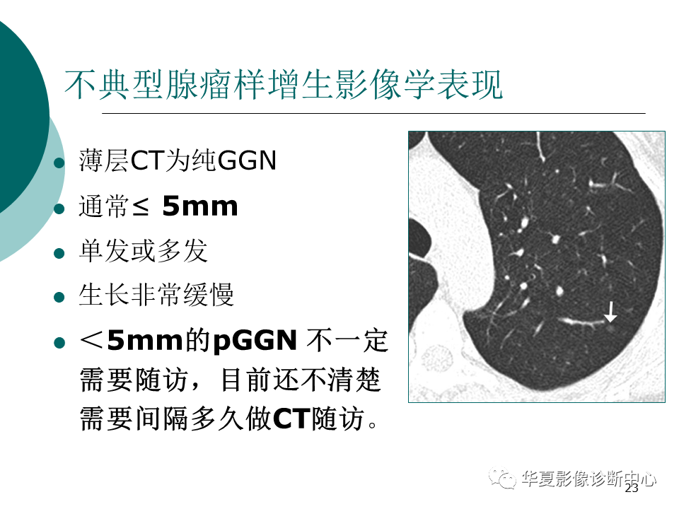 影像PPT - 【PPT】肺腺癌的新分类及影像学特点-23