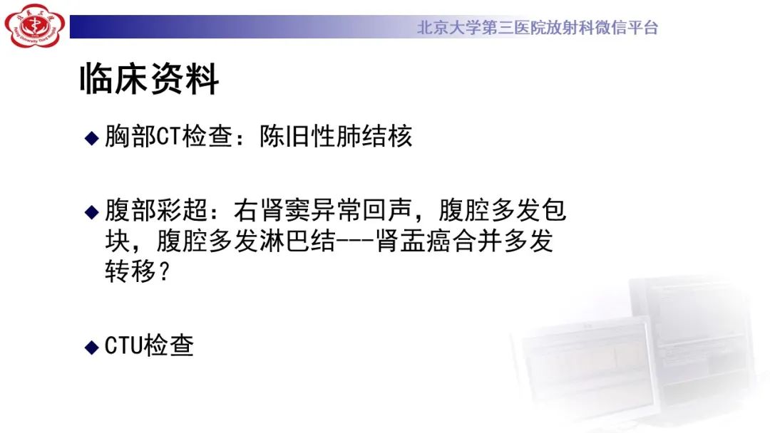 影像PPT - 【PPT】肾脏淋巴瘤-3