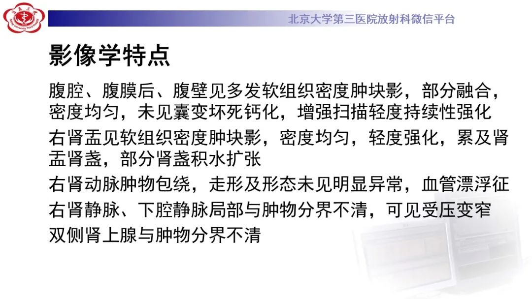 影像PPT - 【PPT】肾脏淋巴瘤-14