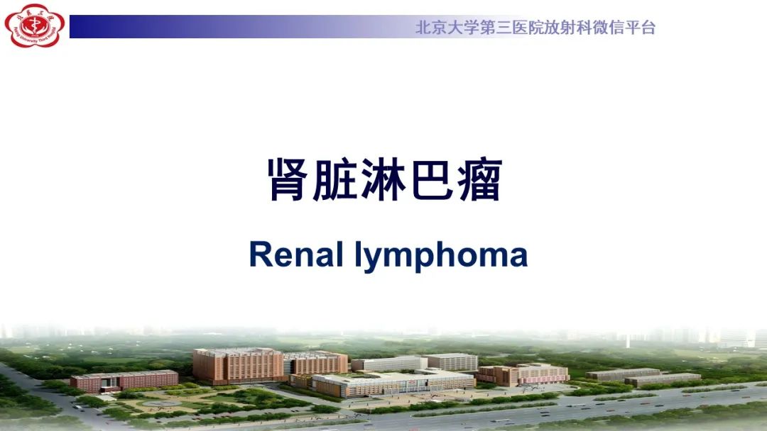 影像PPT - 【PPT】肾脏淋巴瘤-16