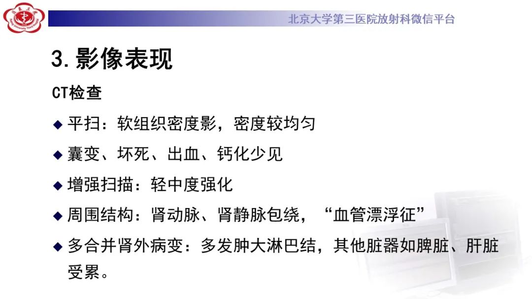影像PPT - 【PPT】肾脏淋巴瘤-20