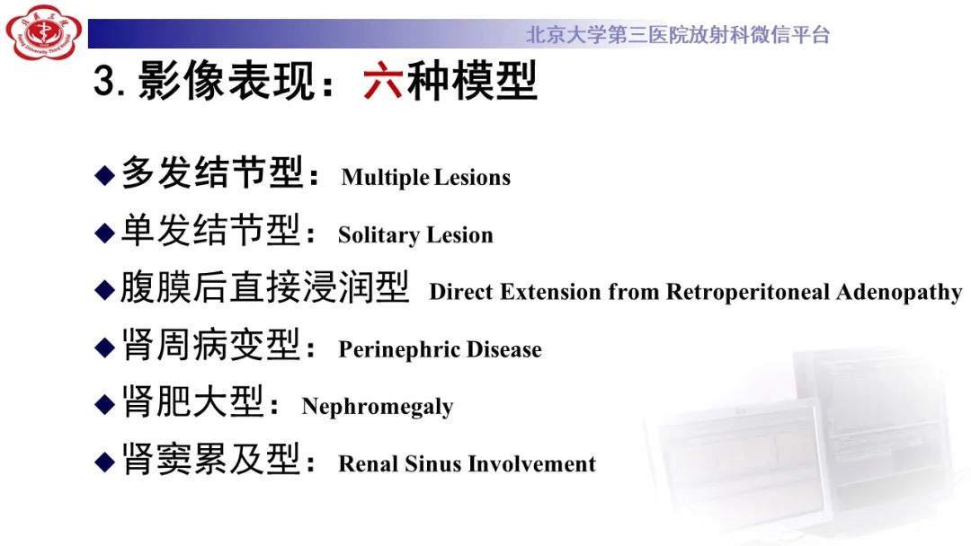 影像PPT - 【PPT】肾脏淋巴瘤-23