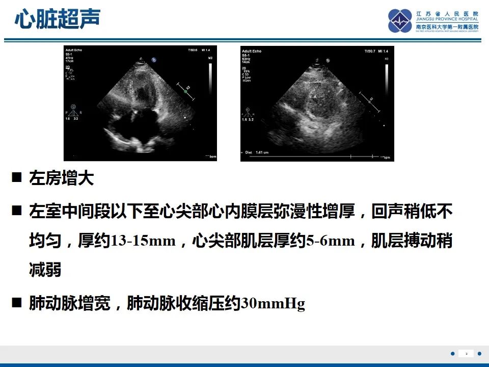 影像PPT - 【PPT】Löffler‘s心内膜炎-4