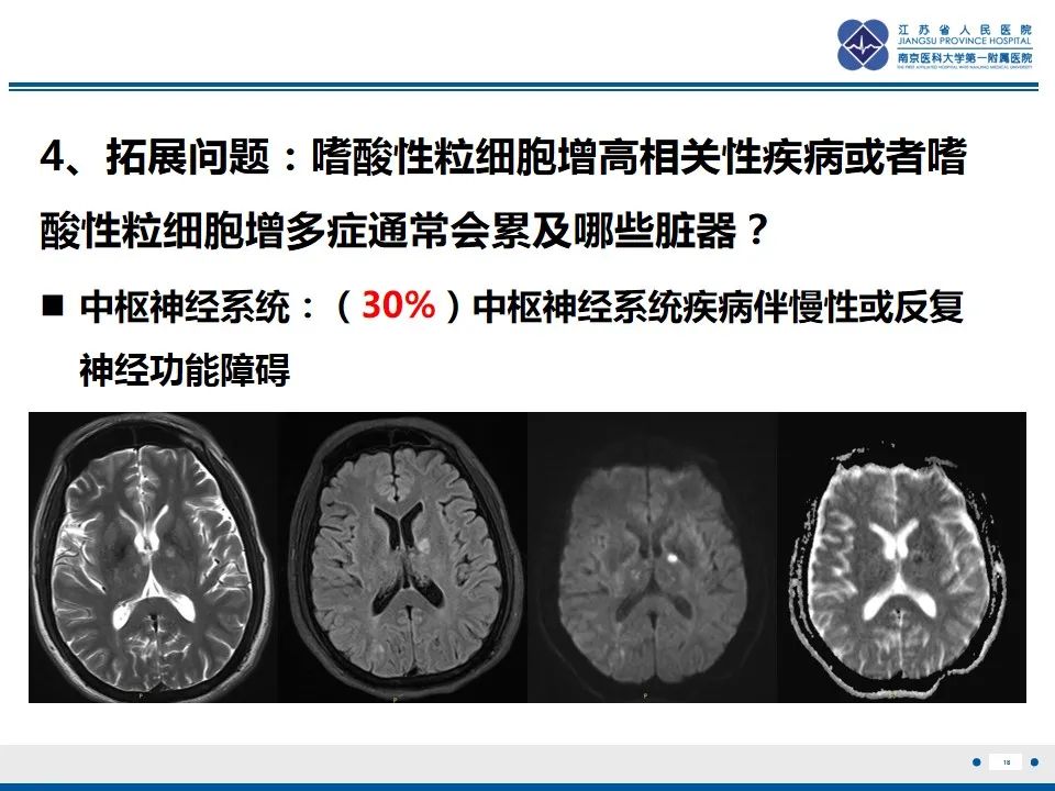 影像PPT - 【PPT】Löffler‘s心内膜炎-19