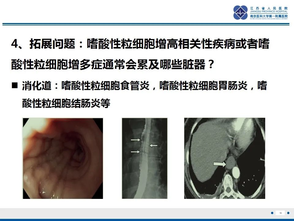影像PPT - 【PPT】Löffler‘s心内膜炎-20