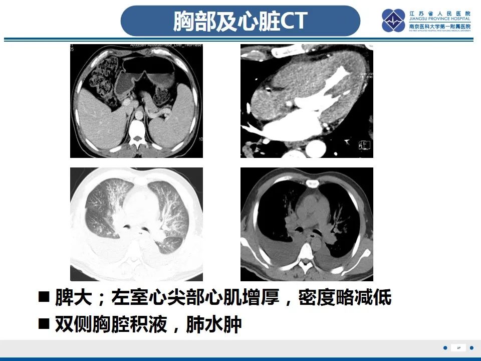 影像PPT - 【PPT】Löffler‘s心内膜炎-28
