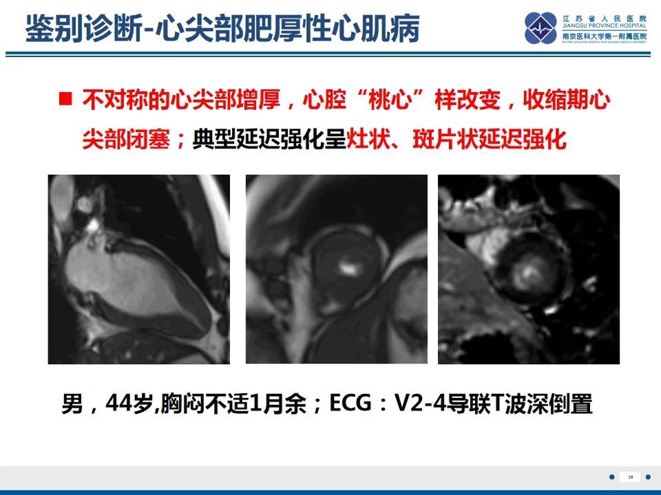 影像PPT - 【PPT】Löffler‘s心内膜炎-36