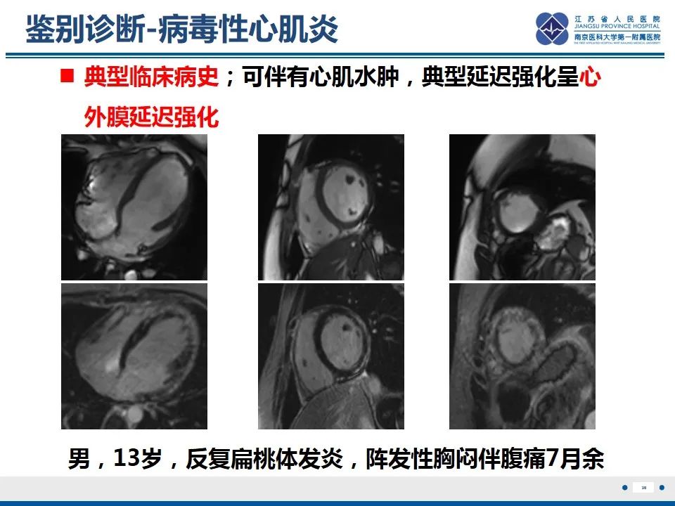 影像PPT - 【PPT】Löffler‘s心内膜炎-37