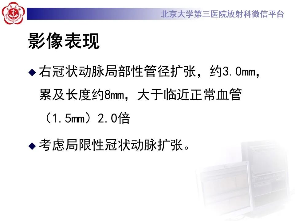 影像PPT - 【PPT】冠状动脉扩张-5