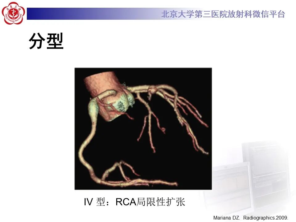 影像PPT - 【PPT】冠状动脉扩张-17