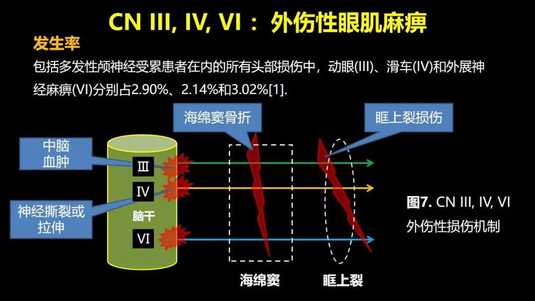 影像PPT - 【PPT】创伤性颅神经损伤的影像表现-17