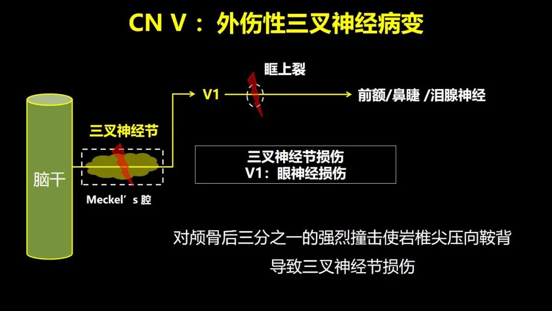 影像PPT - 【PPT】创伤性颅神经损伤的影像表现-25