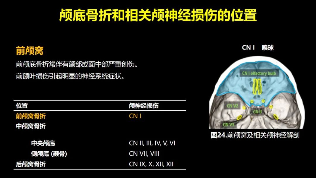 影像PPT - 【PPT】创伤性颅神经损伤的影像表现-49