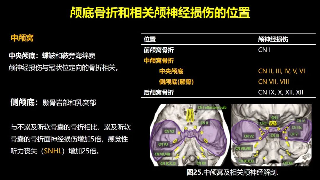 影像PPT - 【PPT】创伤性颅神经损伤的影像表现-51