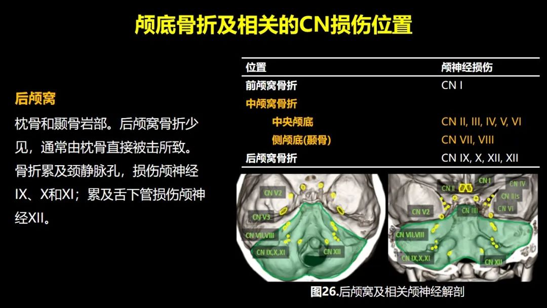 影像PPT - 【PPT】创伤性颅神经损伤的影像表现-53