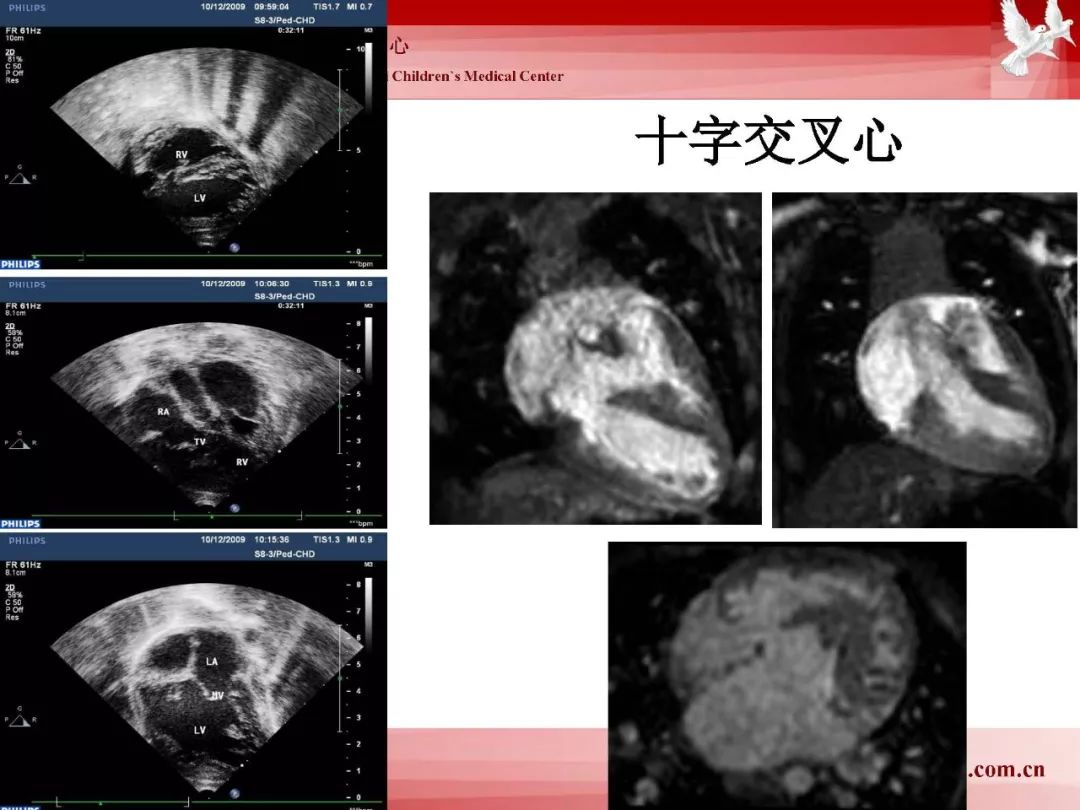 影像PPT - 【PPT】胎儿磁共振检查技术-26