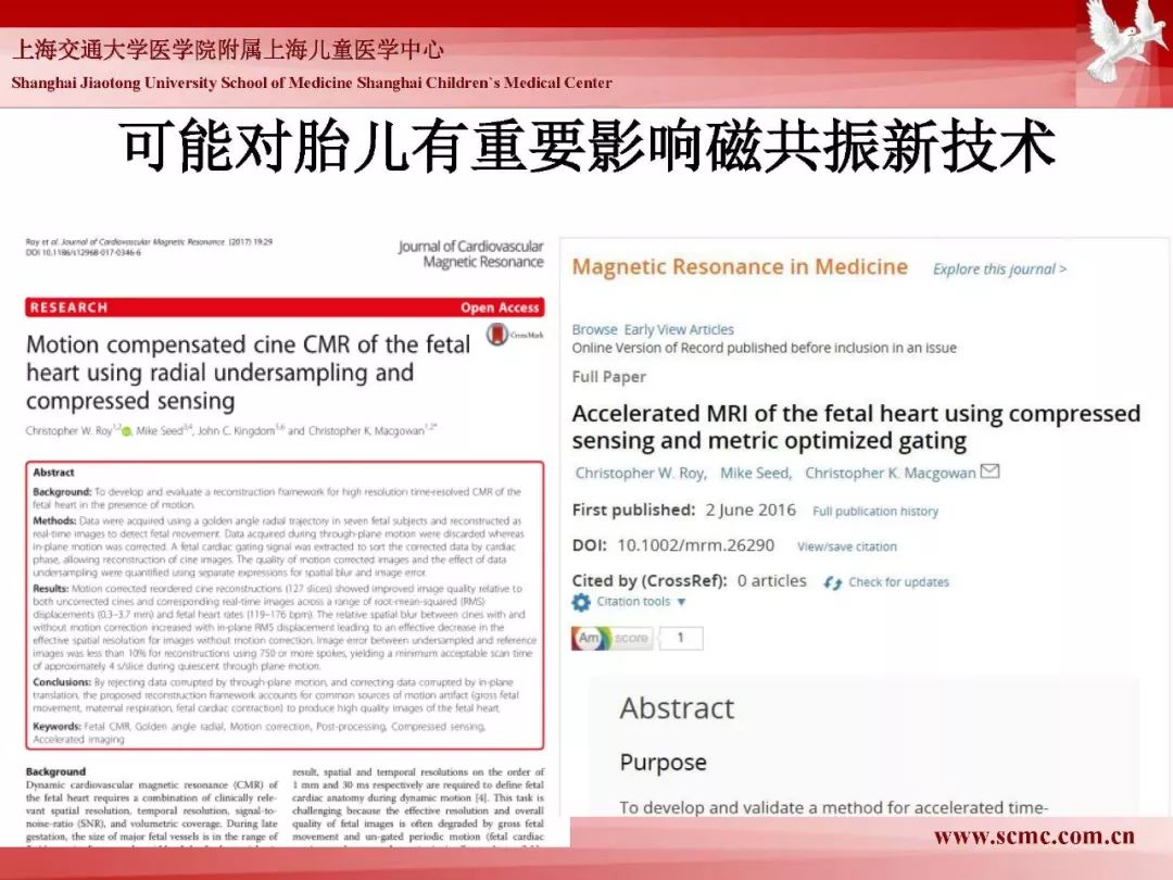 影像PPT - 【PPT】胎儿磁共振检查技术-95