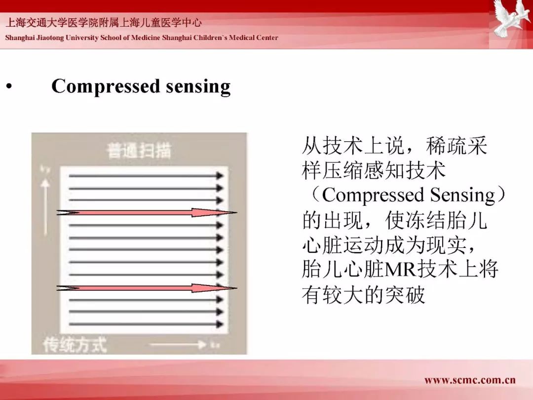 影像PPT - 【PPT】胎儿磁共振检查技术-96