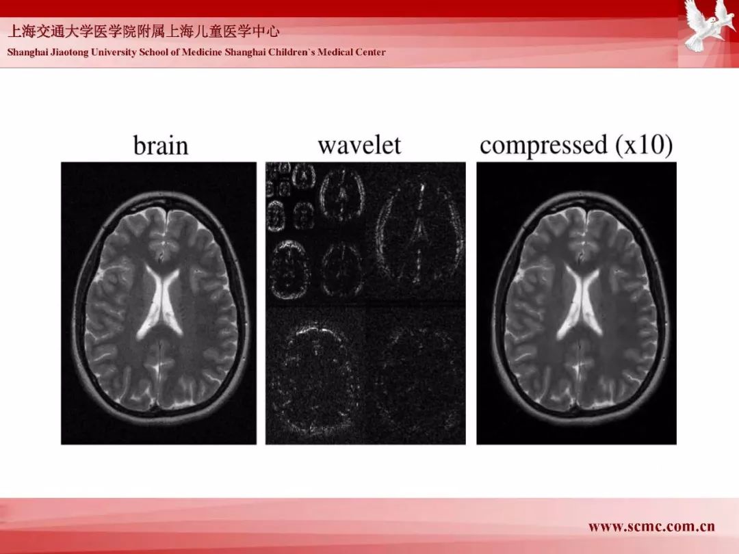 影像PPT - 【PPT】胎儿磁共振检查技术-98