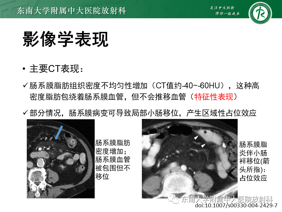 影像PPT - 【PPT】肠系膜脂膜炎-10