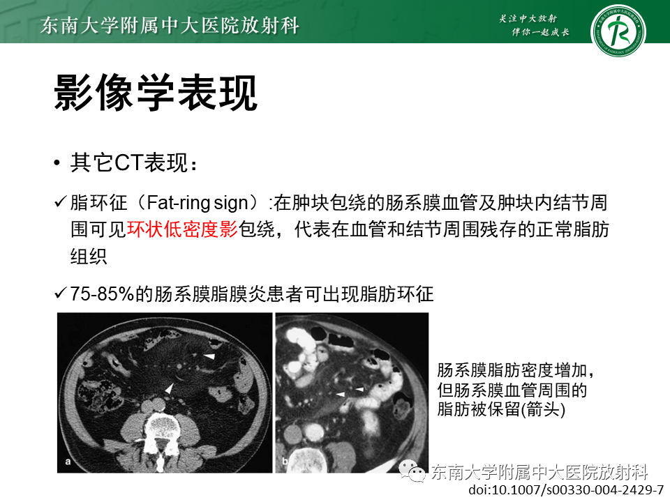 影像PPT - 【PPT】肠系膜脂膜炎-11