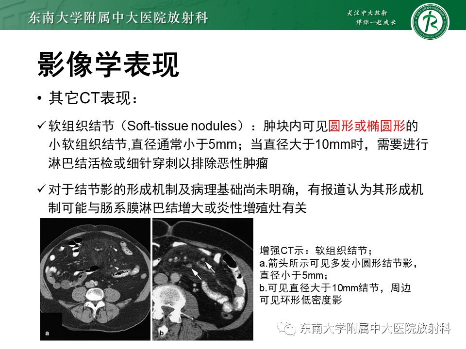 影像PPT - 【PPT】肠系膜脂膜炎-13