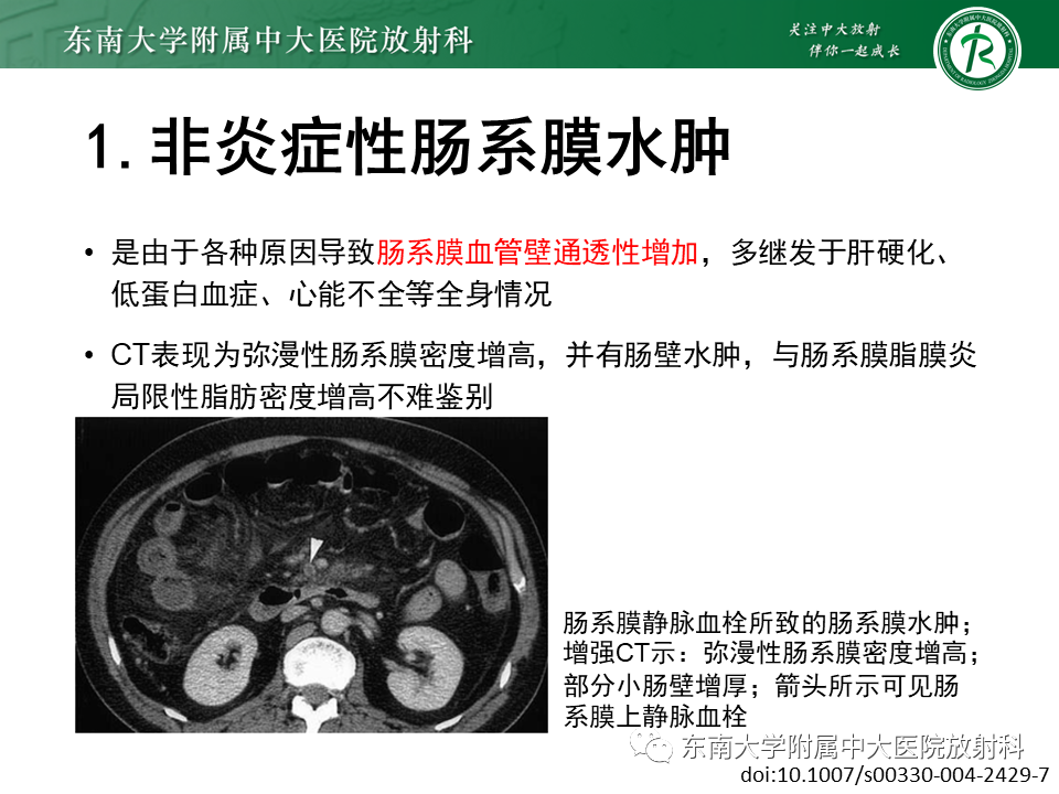 影像PPT - 【PPT】肠系膜脂膜炎-16