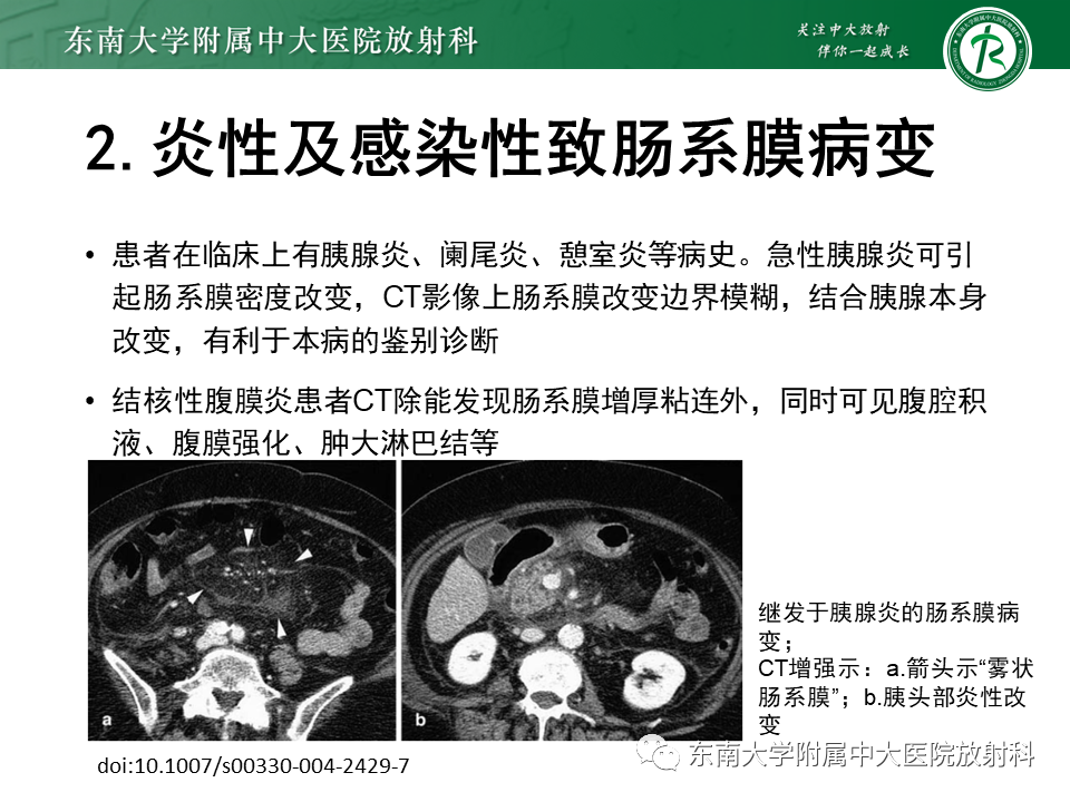影像PPT - 【PPT】肠系膜脂膜炎-18