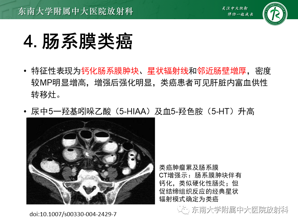 影像PPT - 【PPT】肠系膜脂膜炎-21