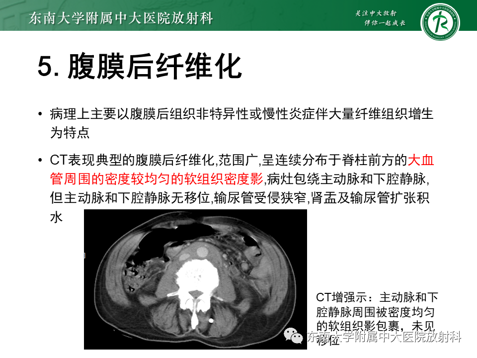 影像PPT - 【PPT】肠系膜脂膜炎-22