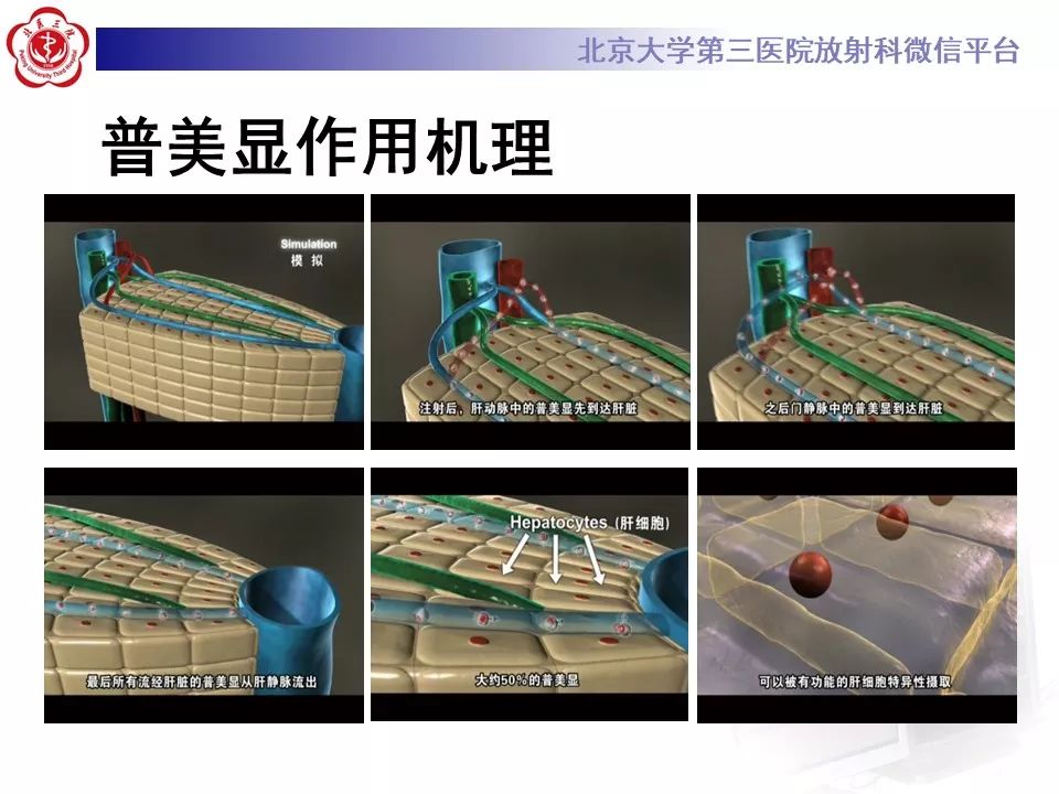 影像PPT - 【PPT】肝胆特异性对比剂的临床应用—肝局灶性病变-6