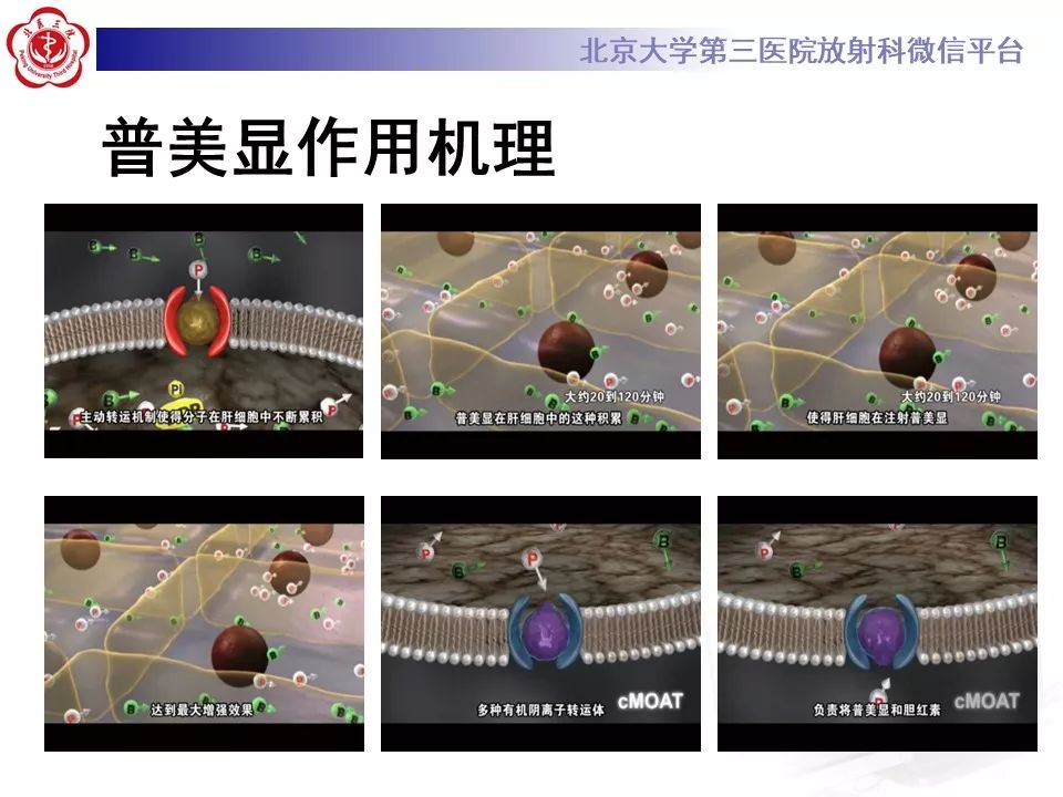 影像PPT - 【PPT】肝胆特异性对比剂的临床应用—肝局灶性病变-7
