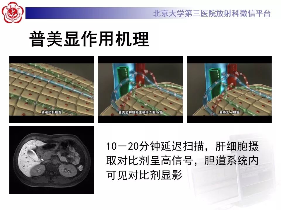 影像PPT - 【PPT】肝胆特异性对比剂的临床应用—肝局灶性病变-8