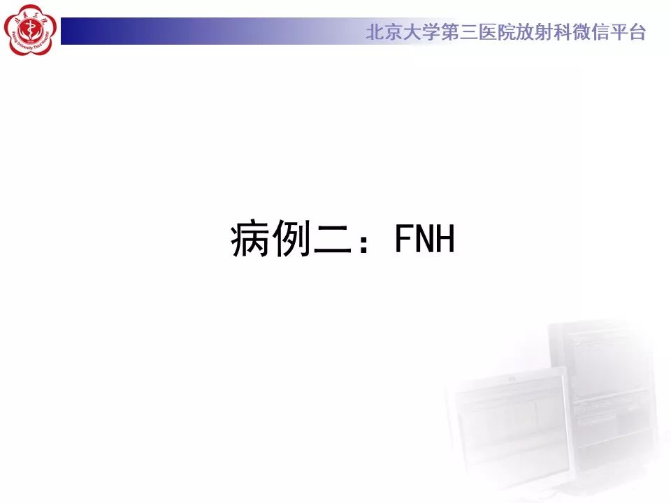 影像PPT - 【PPT】肝胆特异性对比剂的临床应用—肝局灶性病变-19