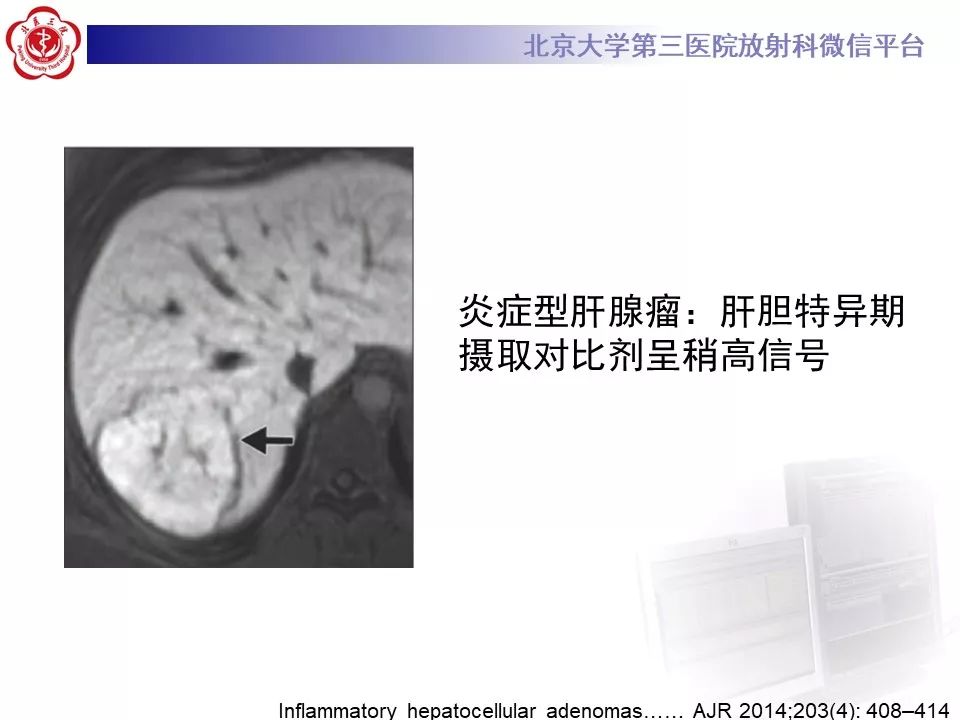 影像PPT - 【PPT】肝胆特异性对比剂的临床应用—肝局灶性病变-26