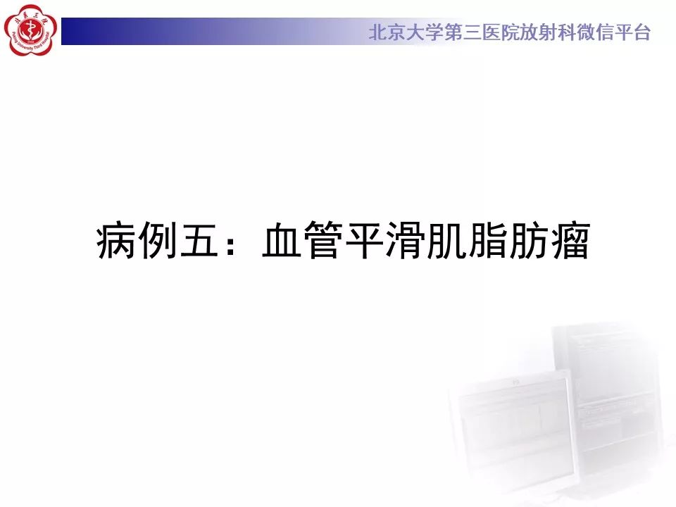 影像PPT - 【PPT】肝胆特异性对比剂的临床应用—肝局灶性病变-39