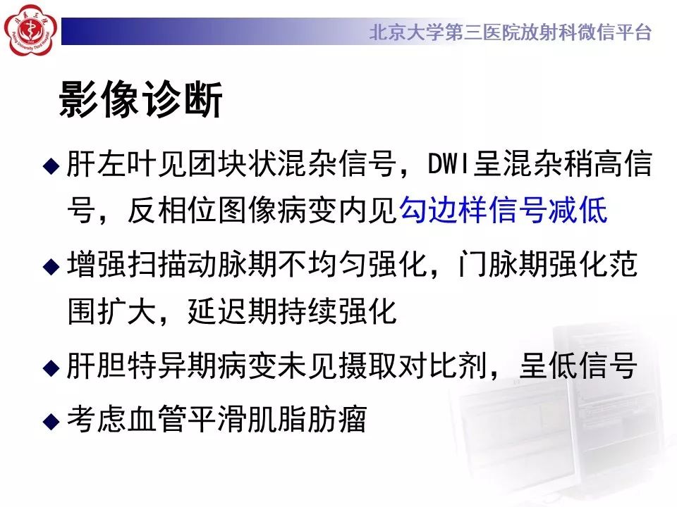 影像PPT - 【PPT】肝胆特异性对比剂的临床应用—肝局灶性病变-43