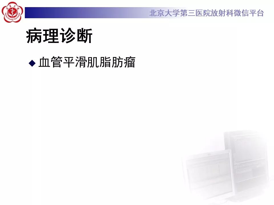 影像PPT - 【PPT】肝胆特异性对比剂的临床应用—肝局灶性病变-44