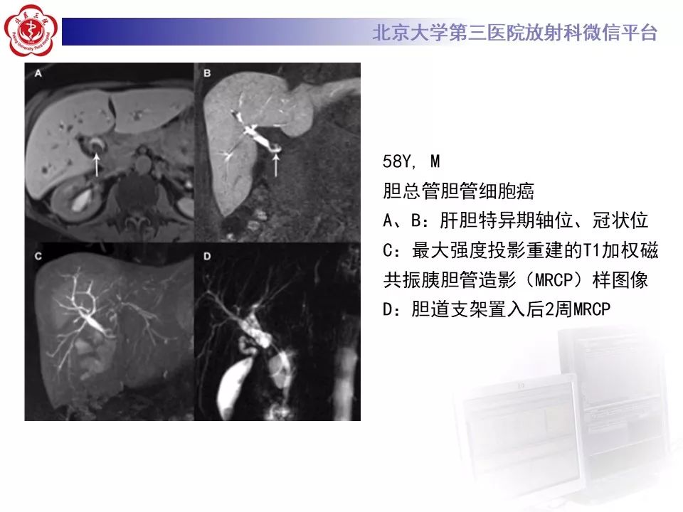 影像PPT - 【PPT】肝胆特异性对比剂的临床应用—肝局灶性病变-72