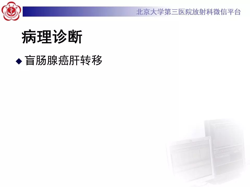 影像PPT - 【PPT】肝胆特异性对比剂的临床应用—肝局灶性病变-79