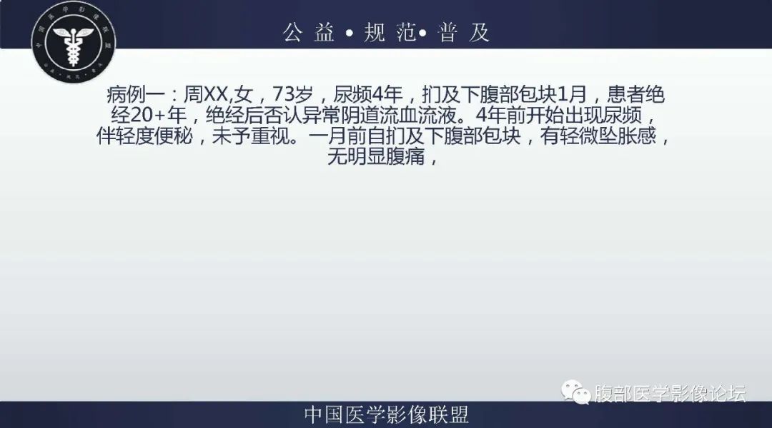 影像PPT - 【病例】卵巢卵泡膜细胞瘤1例MR-2