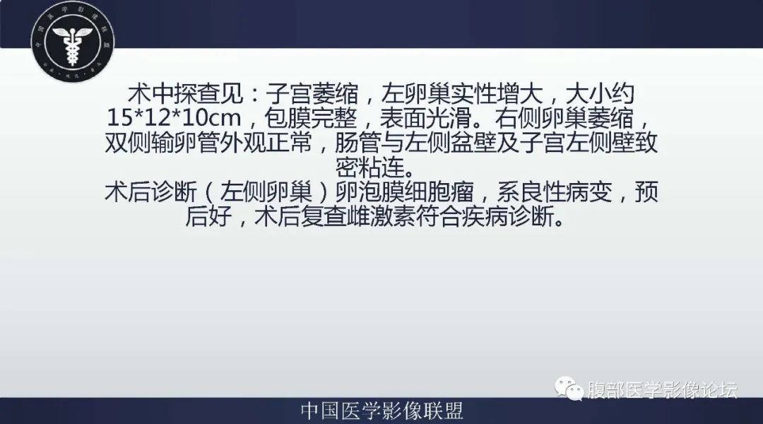 影像PPT - 【病例】卵巢卵泡膜细胞瘤1例MR-10