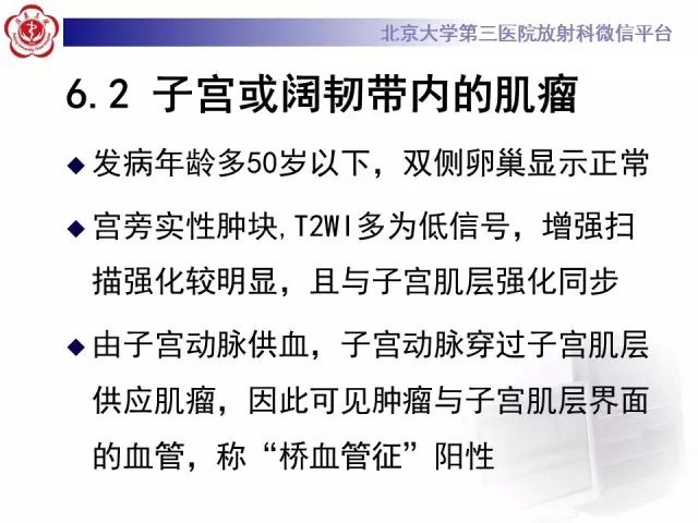 影像PPT - 【病例】卵巢卵泡膜细胞瘤1例MR-20
