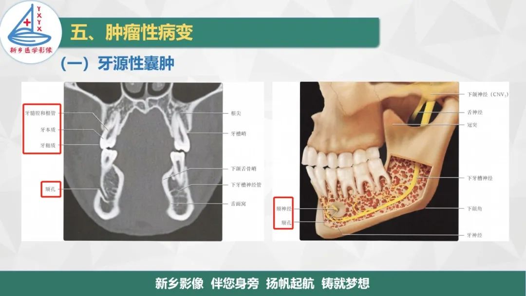 影像PPT - 【PPT】医学影像诊断学教材解读—口腔颌面部疾病2-3