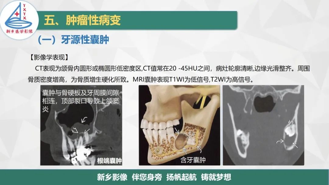 影像PPT - 【PPT】医学影像诊断学教材解读—口腔颌面部疾病2-6