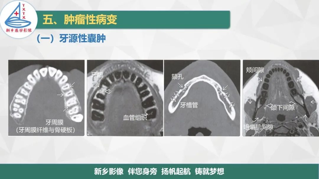 影像PPT - 【PPT】医学影像诊断学教材解读—口腔颌面部疾病2-4
