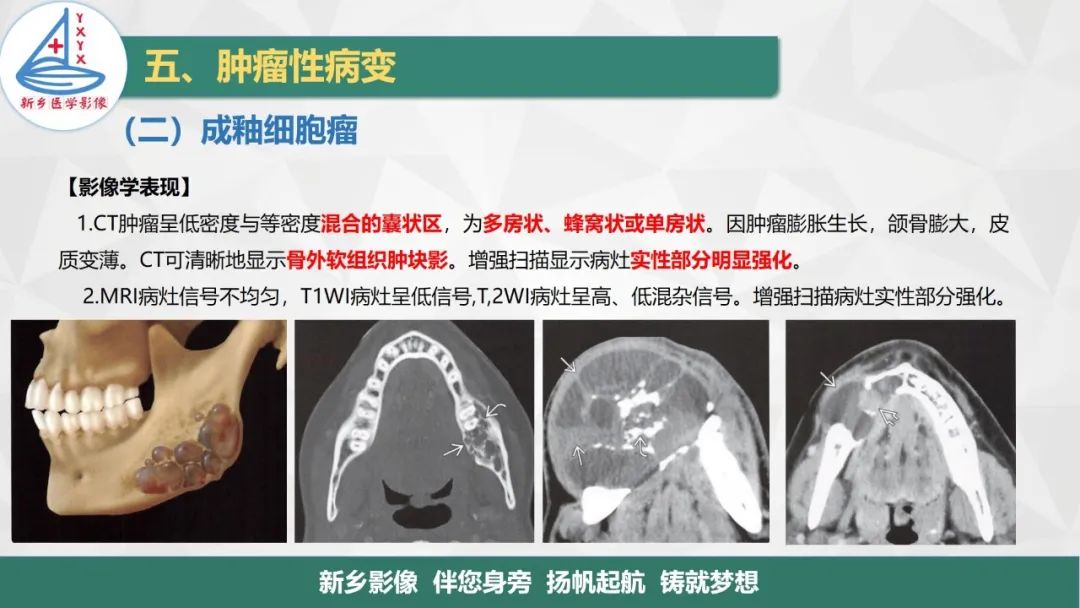 影像PPT - 【PPT】医学影像诊断学教材解读—口腔颌面部疾病2-9