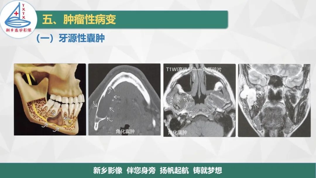 影像PPT - 【PPT】医学影像诊断学教材解读—口腔颌面部疾病2-7