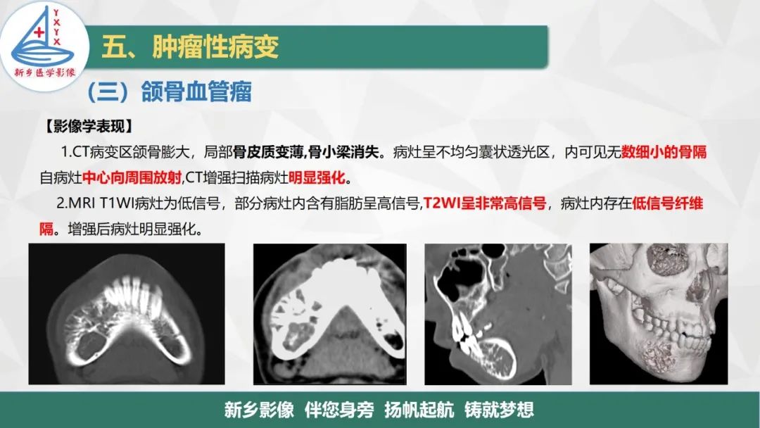 影像PPT - 【PPT】医学影像诊断学教材解读—口腔颌面部疾病2-11