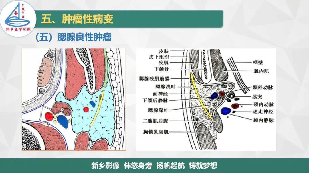 影像PPT - 【PPT】医学影像诊断学教材解读—口腔颌面部疾病2-14